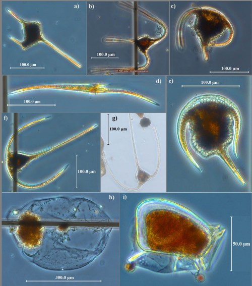Some phytoplankton of cool temperate south-east Tasmania. Many of these are warm water species that have been carried south by the ever stronger East Australian Current. (A µg is 1/100th of a millimetre.) Photos by Pearse Buchanan